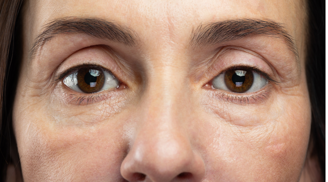 How Stress Affects Your Skin